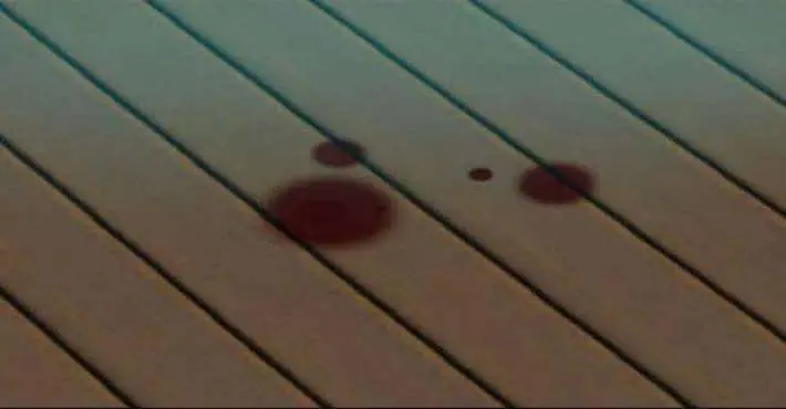 Killing Stalking – Capítulo 33 Yaoi – Página 140